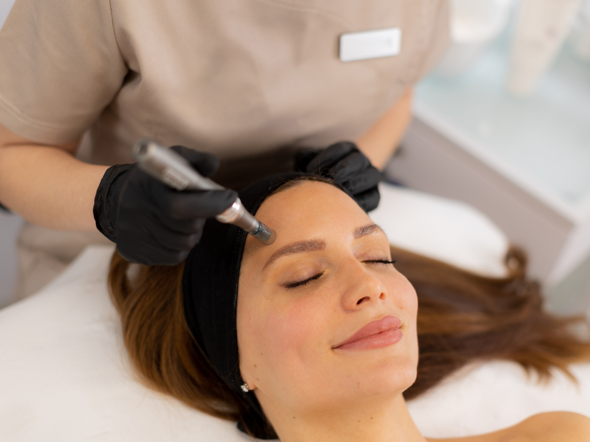 Skinpen Microneedling in Douglasville GA