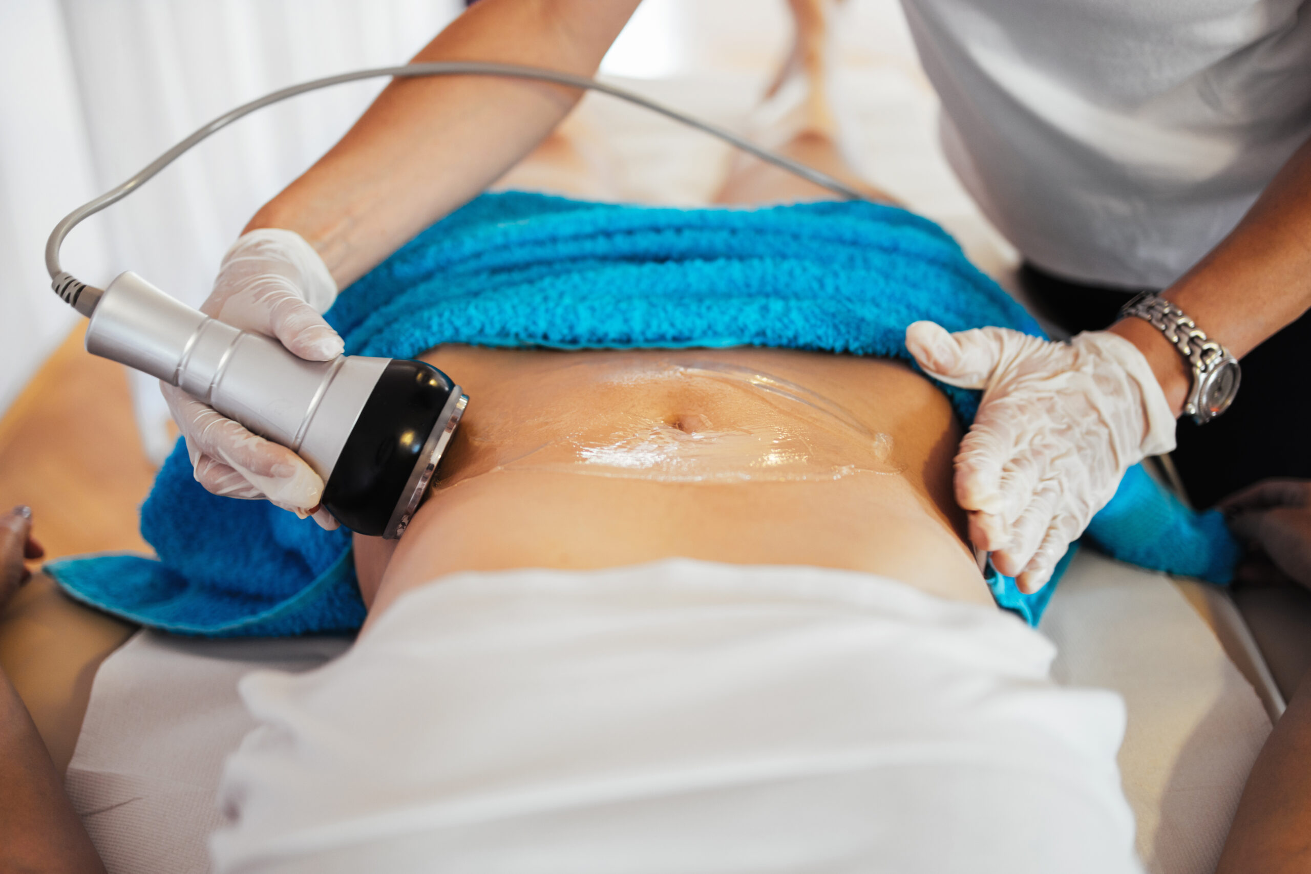 Body Contouring Treatment at Infinity Med Spa in Douglasville, GA