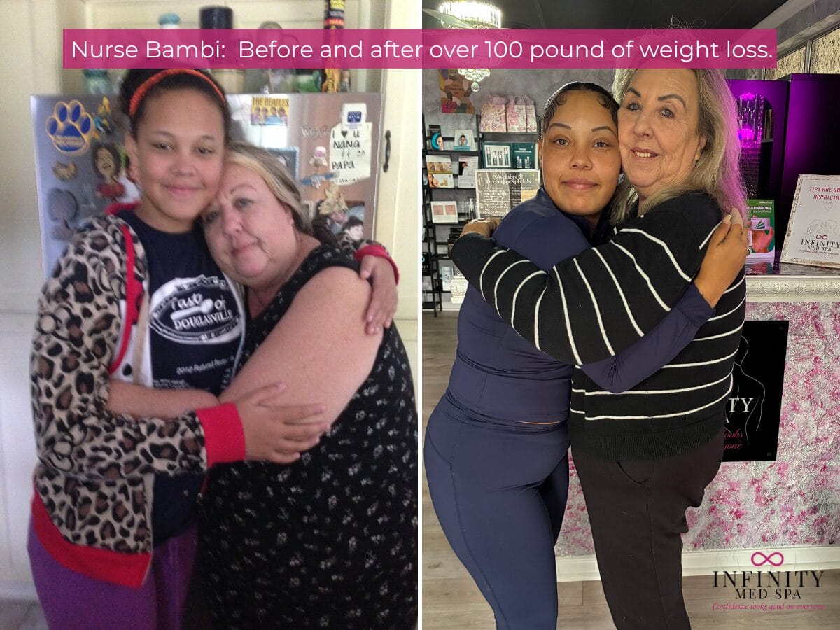 Bambi Weight Loss Journey in Douglasville GA - Real Patients Real results Bambi Weight Loss Journey in Douglasville GA - Real Patients Real results