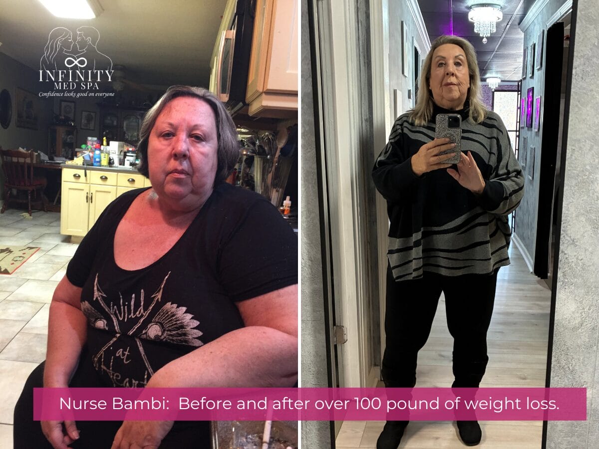 Bambi Weight Loss Journey at Infinity Med Spa GA