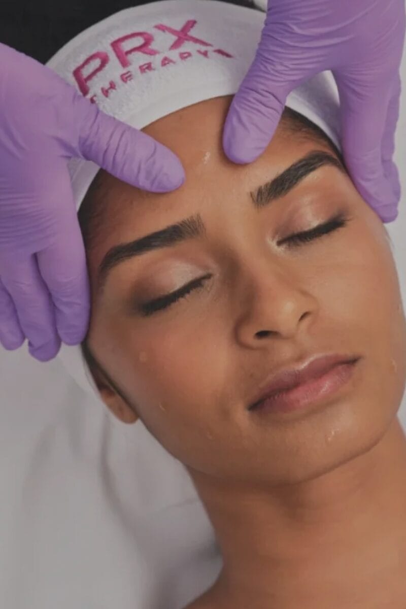 PRX DermPerfexion and PRX Plus treatment in Douglasville, GA