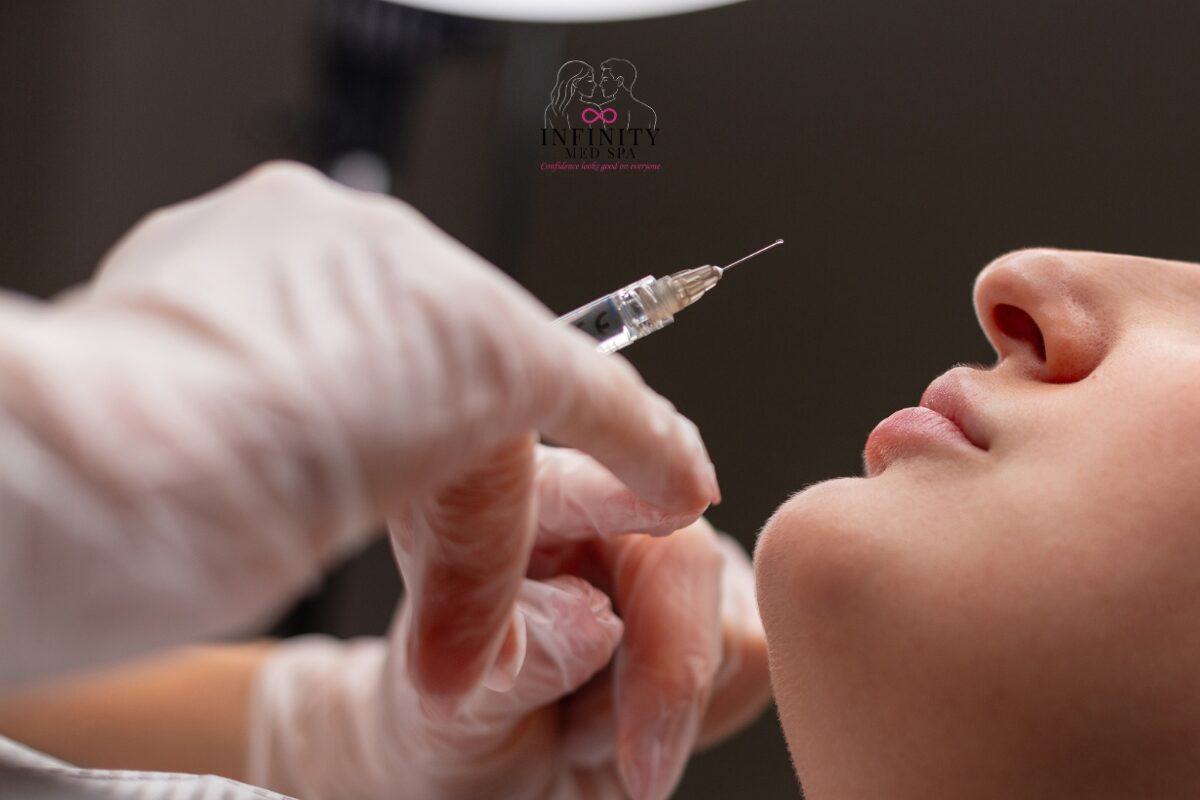 RHA filler treatment for smile lines and lower face in Douglasville Georgia RHA filler treatment for smile lines and lower face in Douglasville Georgia